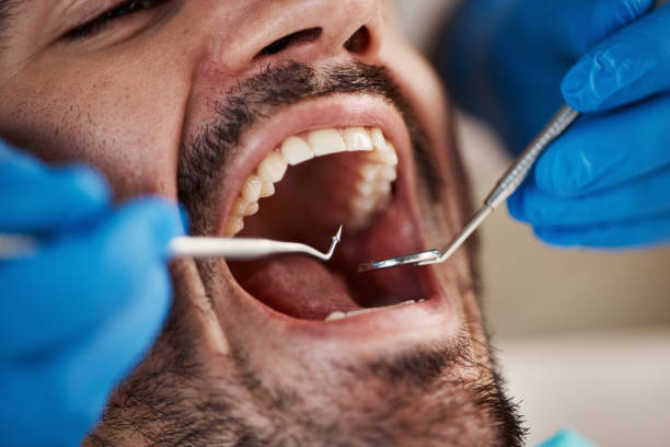 Dental Bonding in Weldon Spring, MO